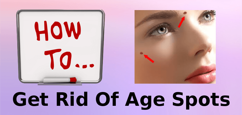 How To Get Rid Of Age Spots