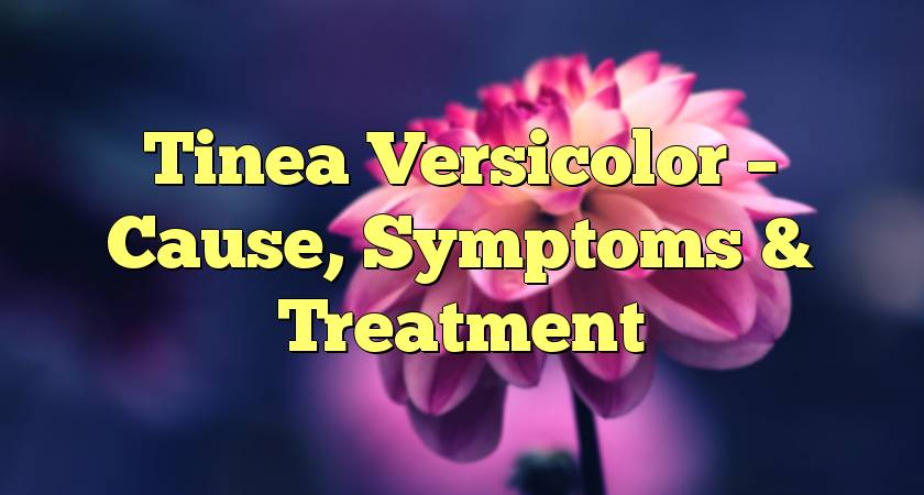 Tinea Versicolor – Cause, Symptoms & Treatment